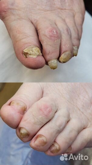 Услуги подолога