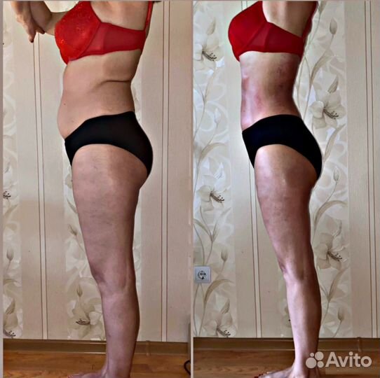 Массаж антицеллюлитный. Уменьшение объемов