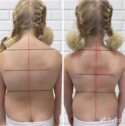 Костоправ мануальщик