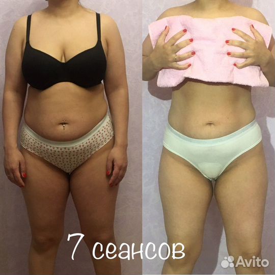 Курс LPG массажа 10 сеансов по 45 мин