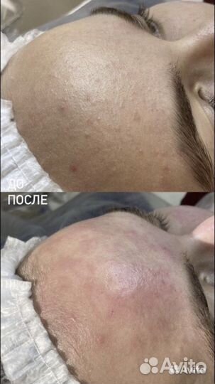 Обучение косметолог-эстетист