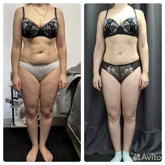 Lpg массаж тело и лицо