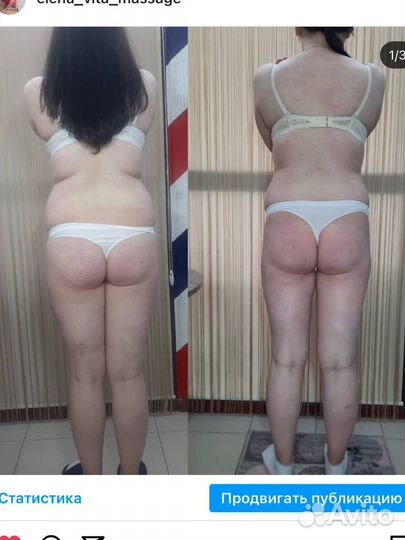 Антицеллюлитный массаж и обертывание