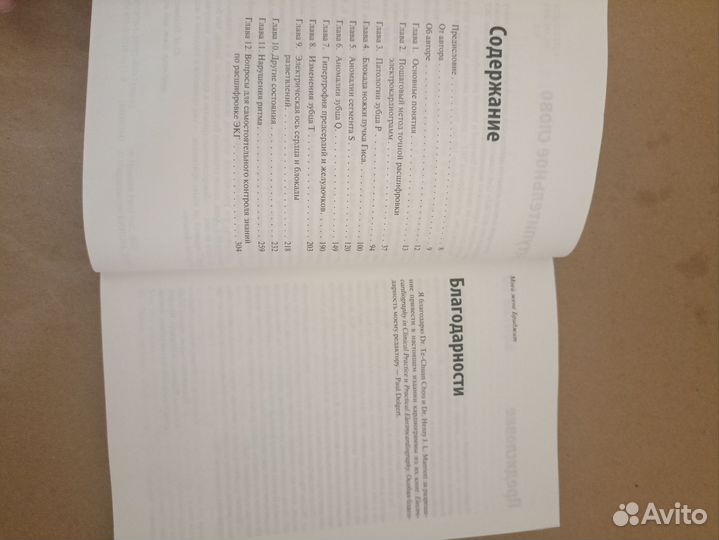 Быстрый анализ экг