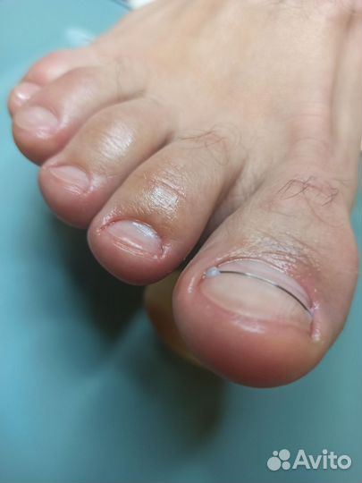 Услуги подолога