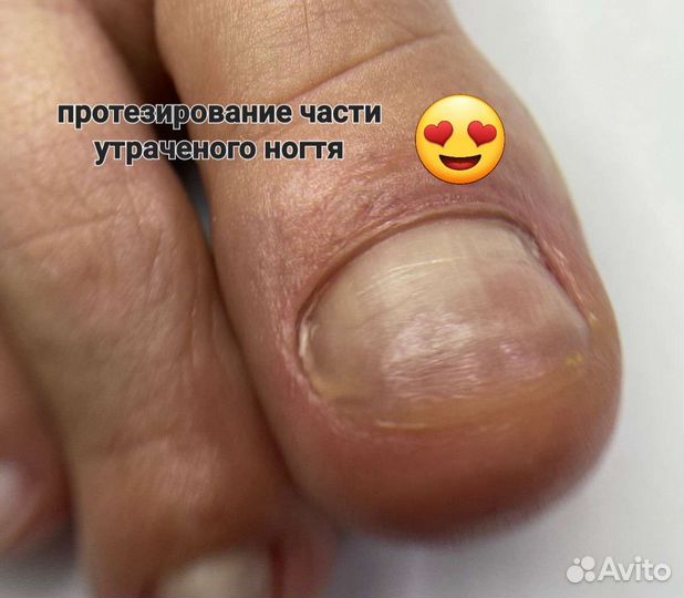 Услуги подолога, мастера педикюра и маникюра