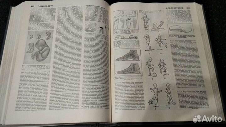 Медицинская энциклопедия 1988г. В хорошем состоян