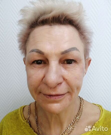 Лифтинг молодости 