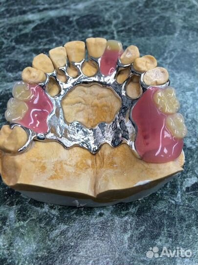 Зубной протез