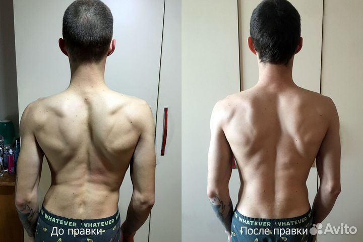 Профессиональный дипломированный костоправ