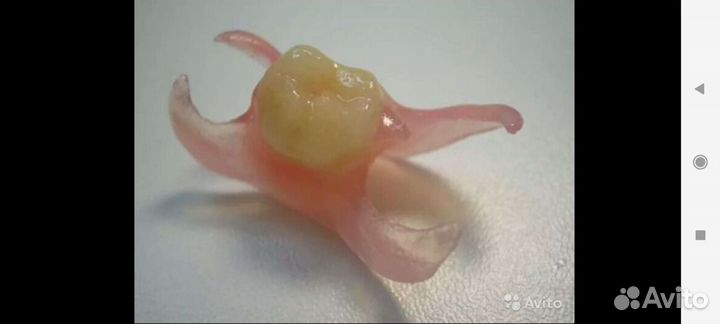 Ремонт изготовление зубные протезы, каппы