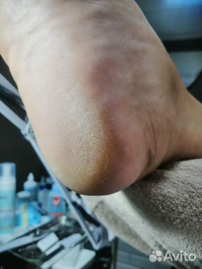 Crazy Маникюр, педикюр, наращивание, укрепление