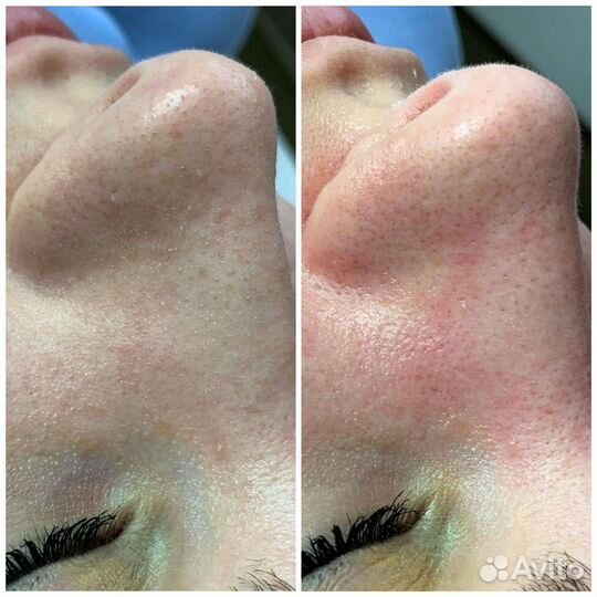 Услуги косметолога