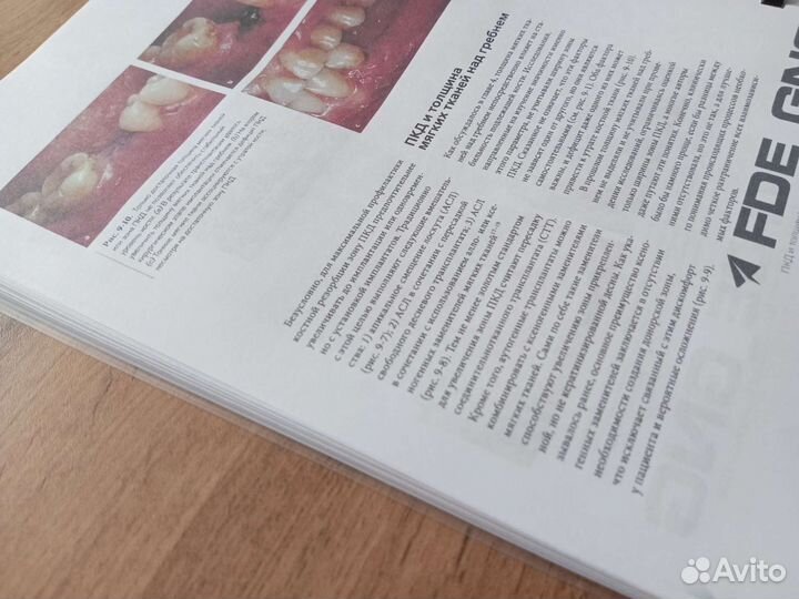 Нулевая утрата кости хирургия