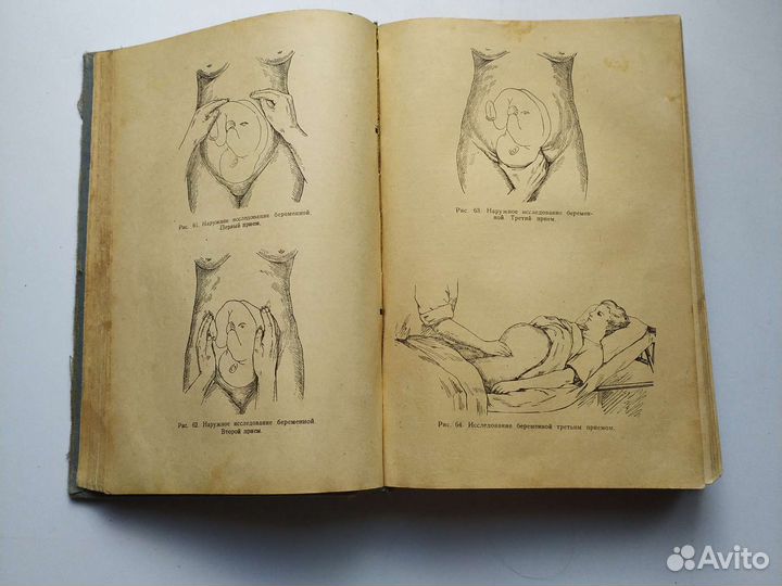 Акушерство 1956г