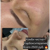 Косметолог ботокс увеличение губ биоревитализация, Химки