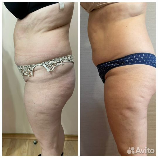 Косметолог массажист