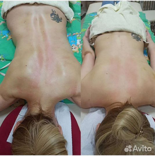 Массаж Костоправ Массажист Костоправ