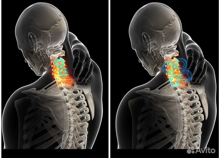 Электрический массажёр для шеи