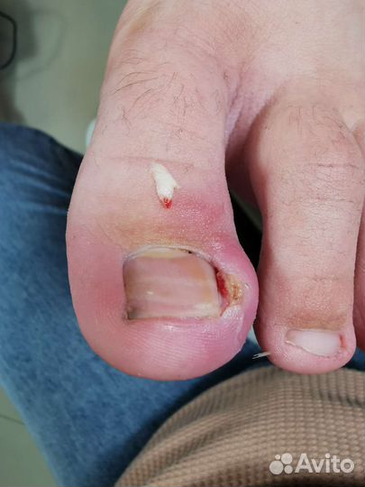 Услуги подолога