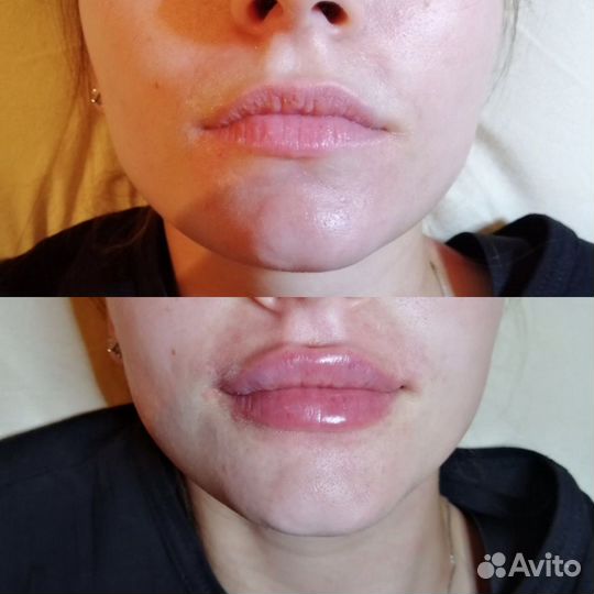 Услуги косметолога