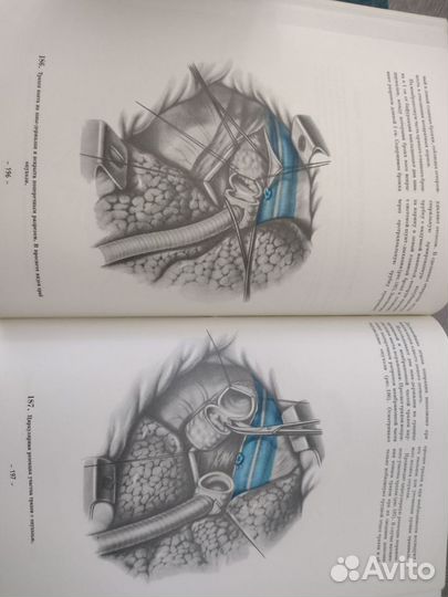 Книга по медицине атлас грудной хирургии 2 тома