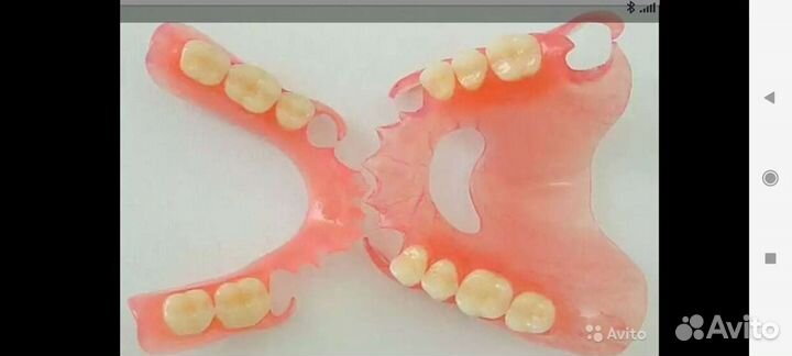 Ремонт изготовление зубные протезы, каппы