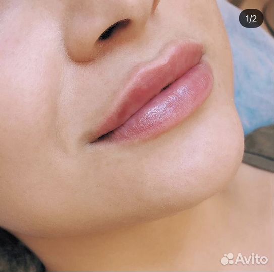 Врач дерматолог, косметолог