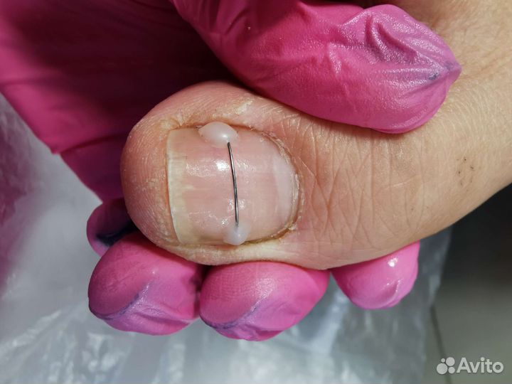 Услуги подолога