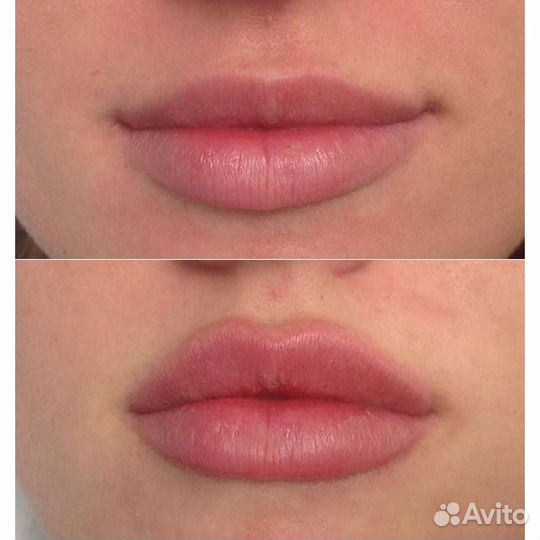 Врач - косметолог