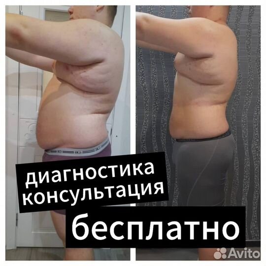 Массаж Антицеллюлитный Коррекция Подтяжка Лица