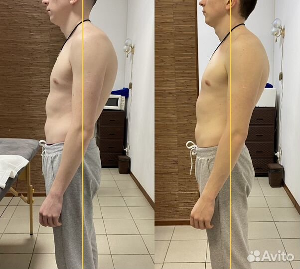 Реабилитация, Массаж, лфк