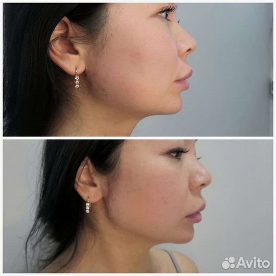 Косметолог.Лицо под ключ (Luxe Face)