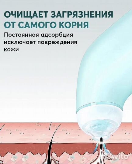 Вакуумный аппарат для чистки лица пор черных точек