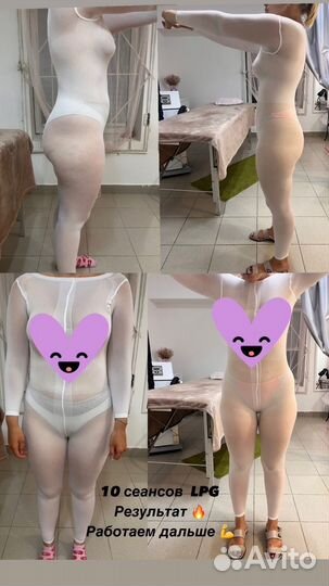 Массаж тела LPG / LPG лица/ мадеротерапия