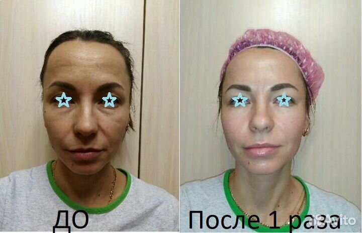 Массаж в Кошелев Парке