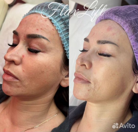 Услуги косметолога