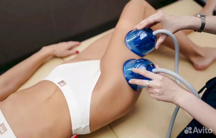 Lpg-аппарат. От производителя Wontek