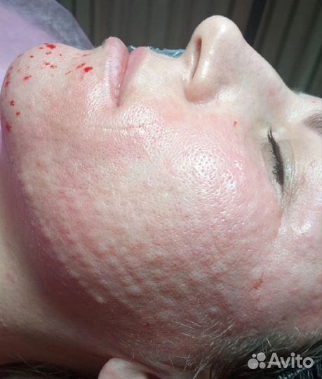 Услуги косметолога