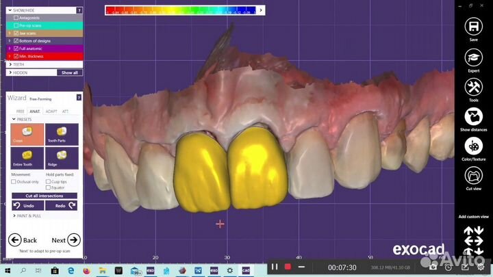 ExoCad 3.1 Rijeka + Exoplan 3.1 Rijeka Актуальные