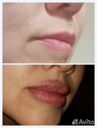 Косметология, татуаж