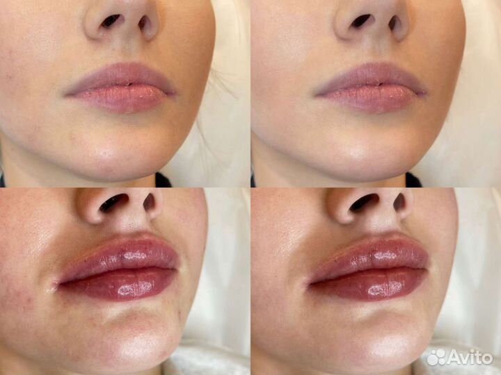 Обработка фотографий удаленно