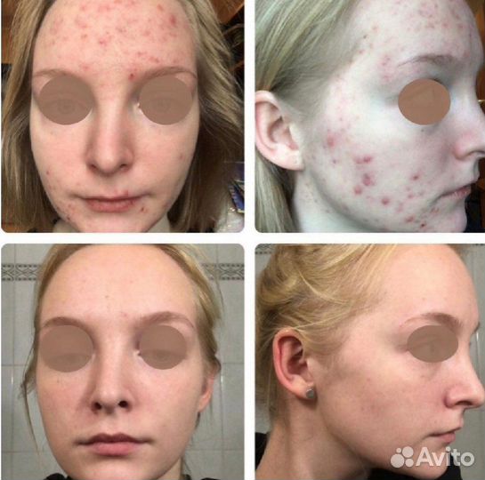 Врач косметолог - дерматолог. Стаж 15 лет