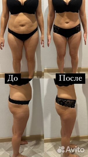 Аппаратный антицеллюлитный массаж сферами