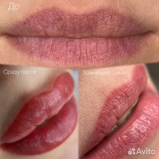 Перманентный макияж бровей, губ и век. Ремувер