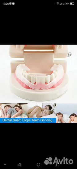 Капа для зубов