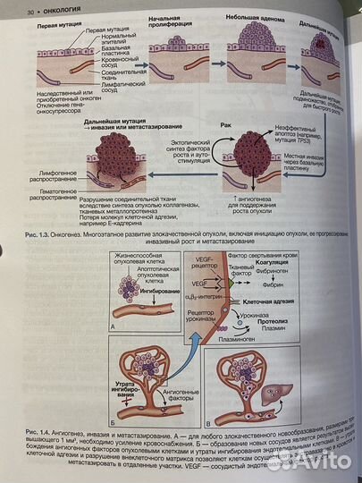 Внутренние болезни по дэвидсону