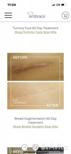 Пластырь послеоперационный против рубцов Embrace