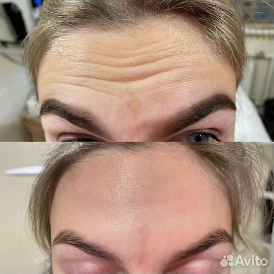 Косметолог / Ботокс / Чистка / Контурная пластика