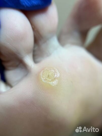 Подолог / маникюр / педикюр